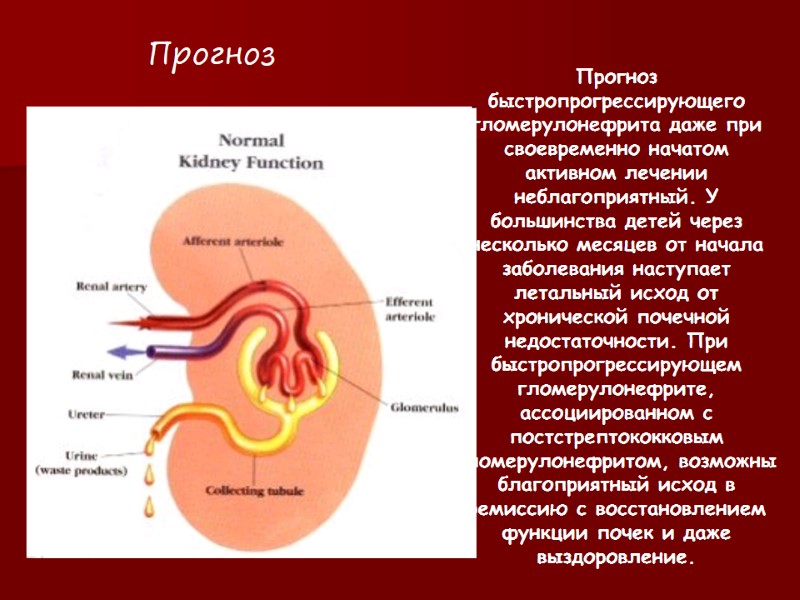 Прогноз быстропрогрессирующего гломерулонефрита даже при своевременно начатом активном лечении неблагоприятный. У большинства детей через